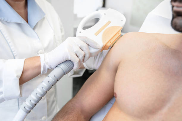 ÉPILATION DES JAMBES POUR LES HOMMES : COMMENT FONCTIONNE L’ÉPILATION DES JAMBES